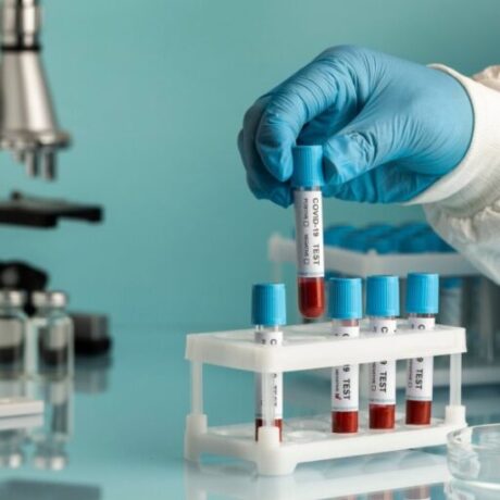 Blood Collection Vacutainer Tubes