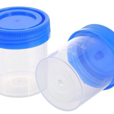 Sputum specimen container