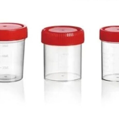 Urine specimen container